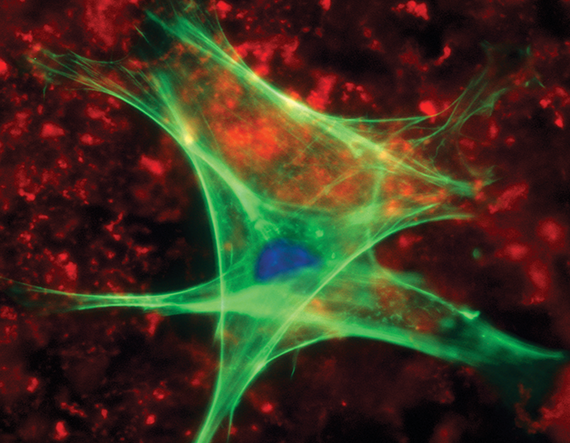 Non-Linear Microscopy